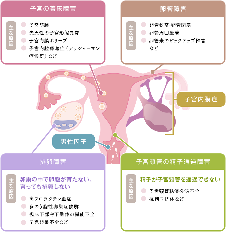 女性側の原因